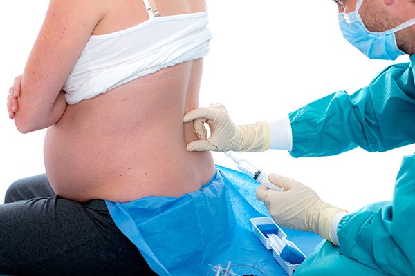 Parto: ¿cómo afecta la epidural al bebé?