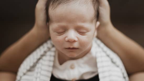 plagiocefalia en bebes